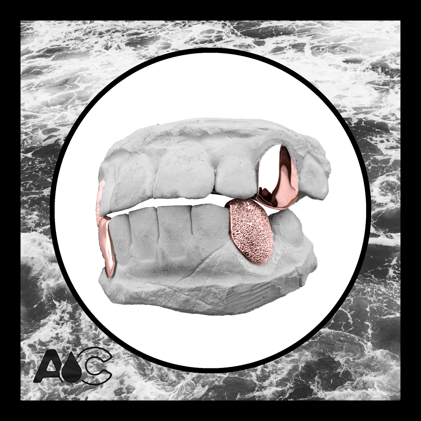 Rose Gold Grillz