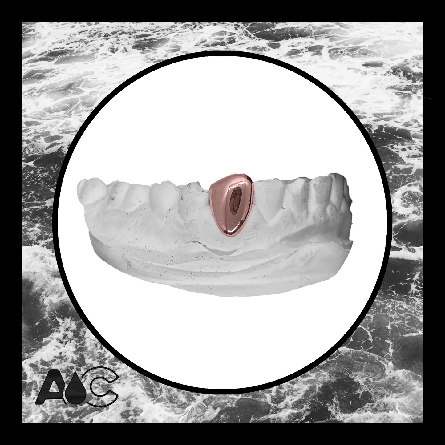 Rose Gold Grillz