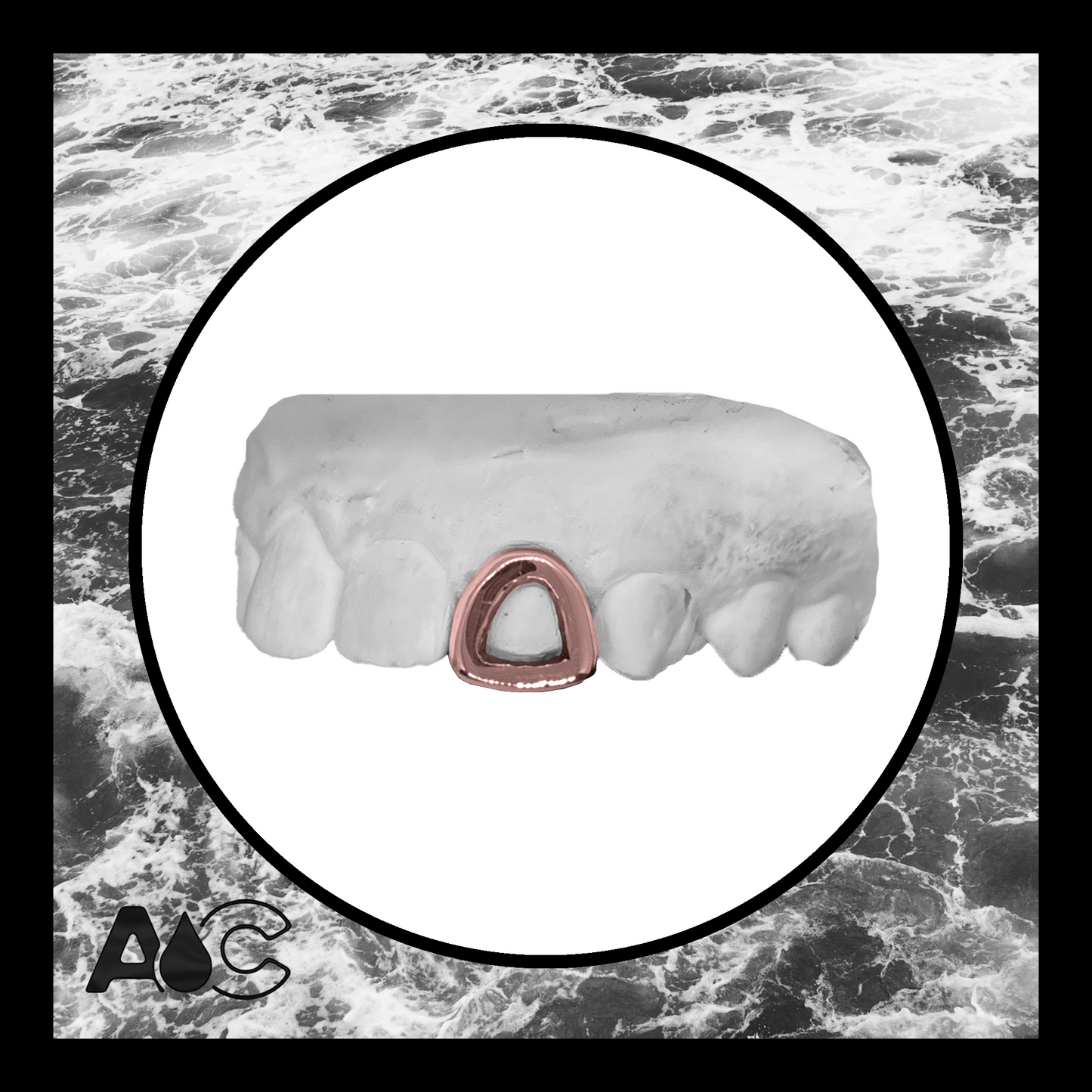 Rose Gold Grillz